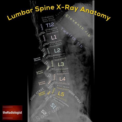 Spine Anatomy Labeled Xray at Katie Eliott blog