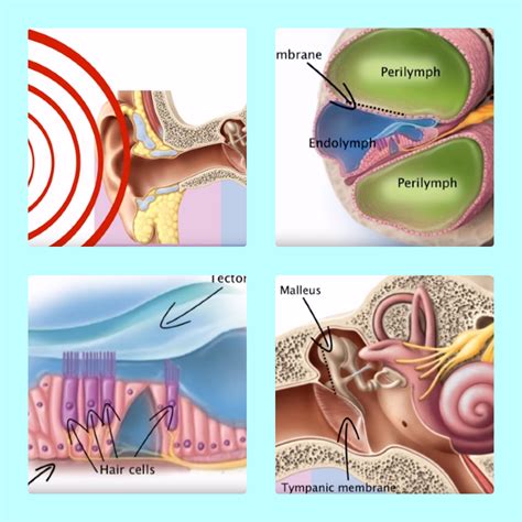 Why Is My Ear Echoing at Terry Prater blog