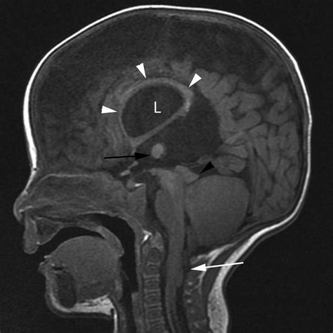 Neuro - Clinical Tree