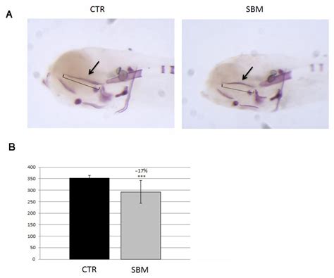 Soybean Meal-Dependent Acute Intestinal Inflammation Delays ...