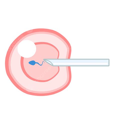 Ivf Icsi Vector Illustration Perfect For Presenting Anything About ...