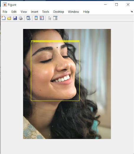 Image result for Face Detection MATLAB Code Using Klt Algorithm