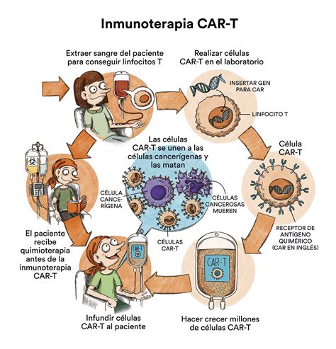 La leucemia linfoblástica aguda en adultos - Fundación Carreras