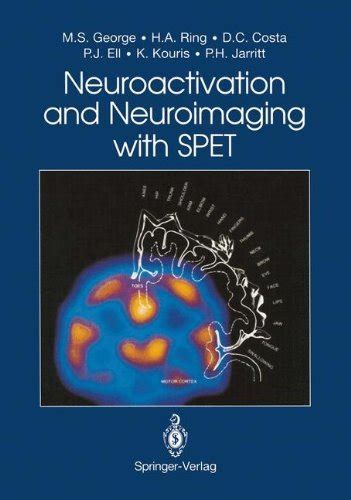 Neuroactivation and Neuroimaging with SPET eBook : George, Mark S ...