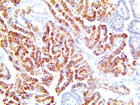 Treponema Pallidum Antibody (RPab) - Bio SB