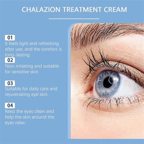 Stye Eye Relief Serum Natural Eyelid Drops for Styes Blepharitis & Chalazion Fast-Acting Relieve ...