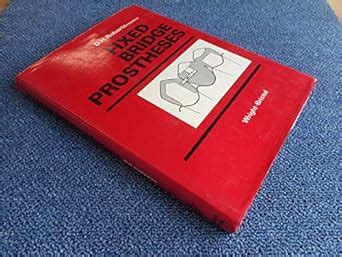 Buy Fixed Bridge Prostheses Book Online at Low Prices in India | Fixed ...