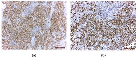 Molecular Pathology and Targeted Therapies for Personalized Management ...