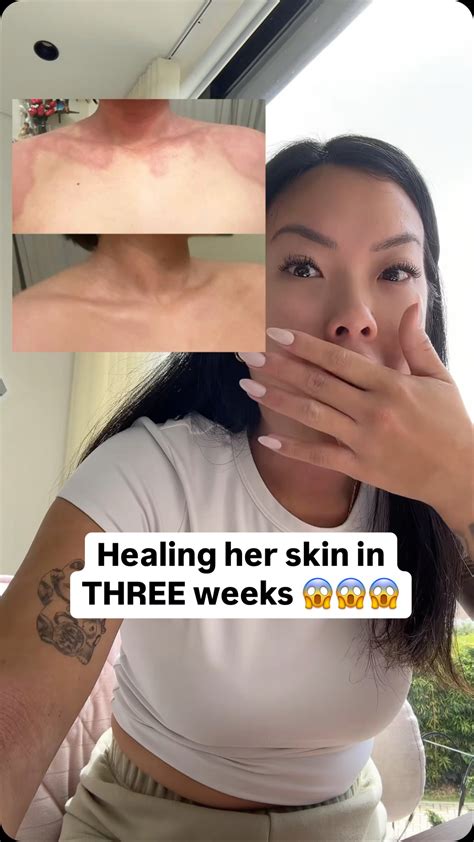 Julia | Functional Dietitian - Gut, Skin & Inflammation (@juliachien.rd) • Instagram photos and ...