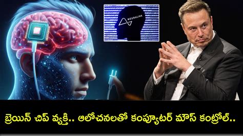 Neuralink : న్యూరాలింక్ ప్రయోగంలో మరో ముందడుగు.. బ్రెయిన్ చిప్ వ్యక్తి ...
