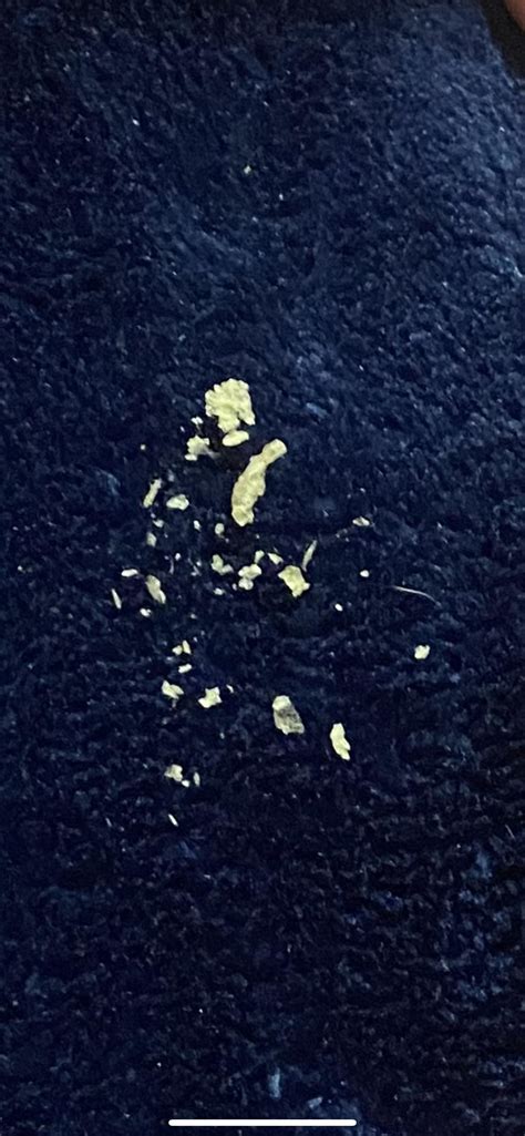 What is this white stuff in my ear? : r/earwax