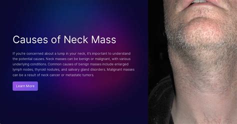 Causes of Neck Mass