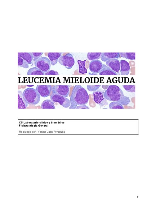 Leucemia mieloide aguda - LEUCEMIA MIELOIDE AGUDA CS Laboratorio ...