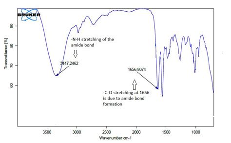 Transferrin anchored solid lipid nanoparticles for brain cancer treatment