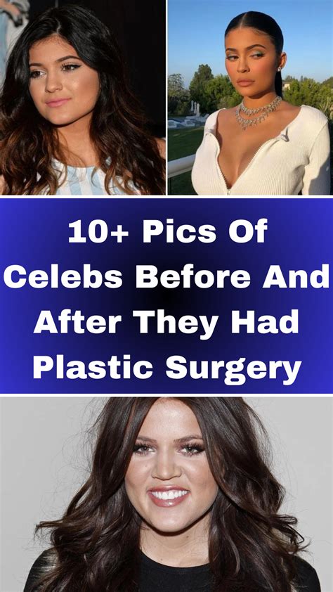 Selena gomez s health struggle hands shake from lupus medication – Artofit