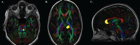 Image result for fMRI Python