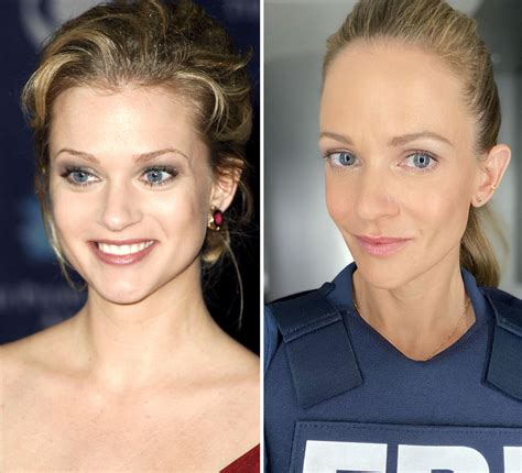 Aj Cook Face Surgery