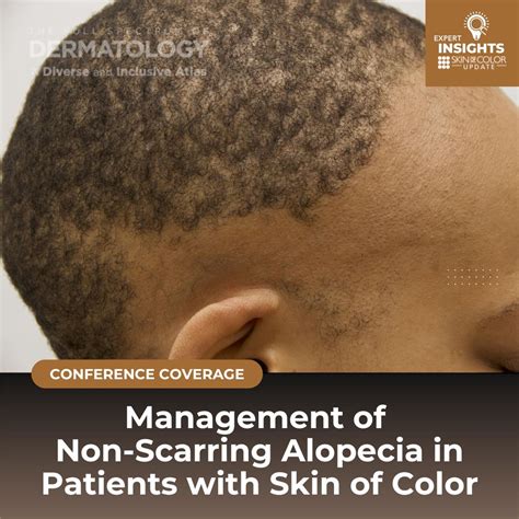 Non Scarring Alopecia Scarring Alopecia The London Skin And Hair