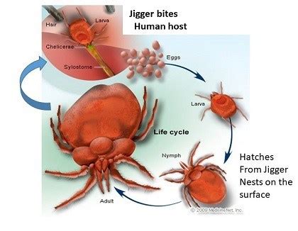 Image result for Jigger Bug Parasite