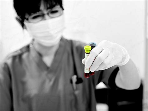 Image result for D-dimer Normal Lab Range