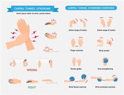 Premium Vector | Carpal tunnel syndrome infographic vector illustration