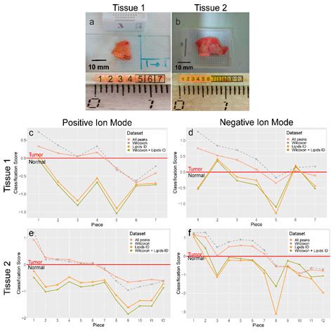 Validation of Breast Cancer Margins by Tissue Spray Mass Spectrometry