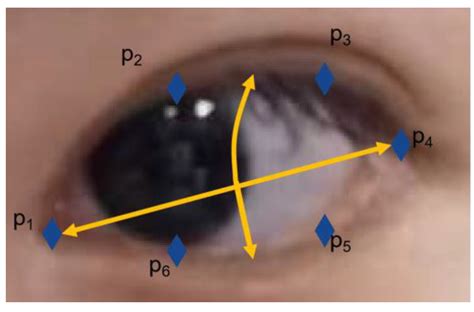 Eye-Gaze Controlled Wheelchair Based on Deep Learning