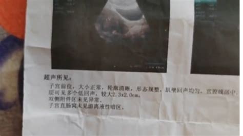 42岁男子体检，报告单显示肚里有“子宫”！-桂林生活网新闻中心