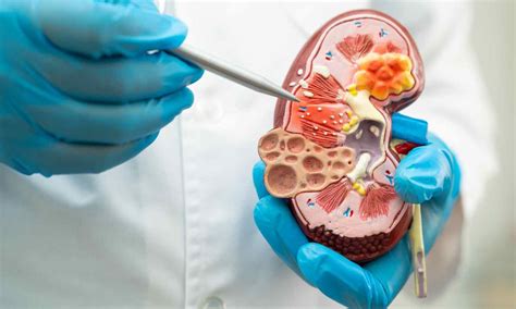 Sacubitril-Valsartan Improves Cardiac Function Despite Kidney Decline ...