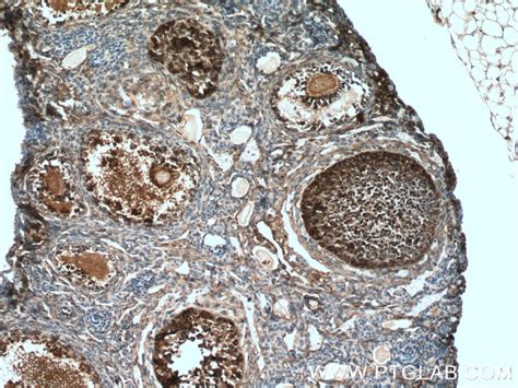 UBC12 antibody (14520-1-AP) | Proteintech