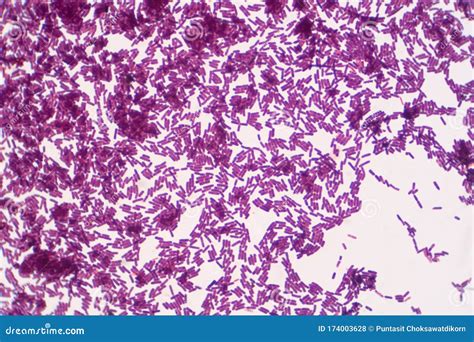Bacillus Gram Positive Stain Under Microscope View. Bacillus is Rod ...