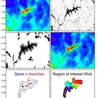 Image result for Sebaceous Filament Extraction