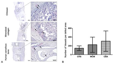 Treatment of Critical-Size Femoral Bone Defects with Chitosan Scaffolds ...