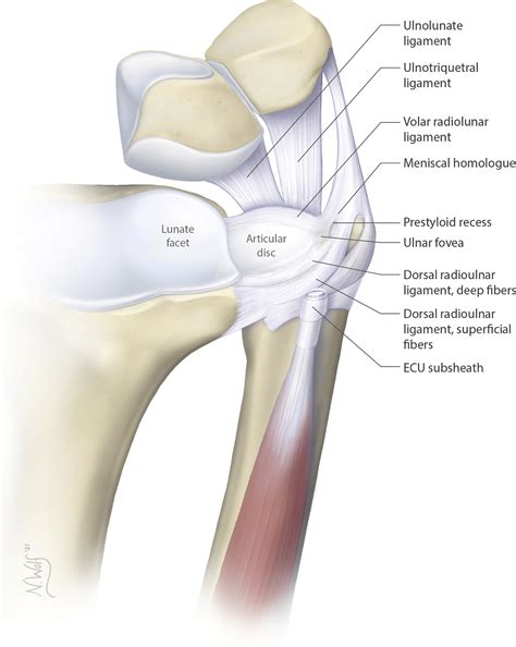 Triangular Fibrocartilage Complex Injuries in Children and Adolescents - Hand Clinics