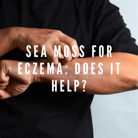 Does Sea Moss Help With Eczema at Phyllis Mosier blog