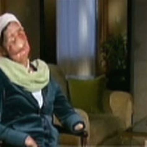 Orangutan Face Ripped Off