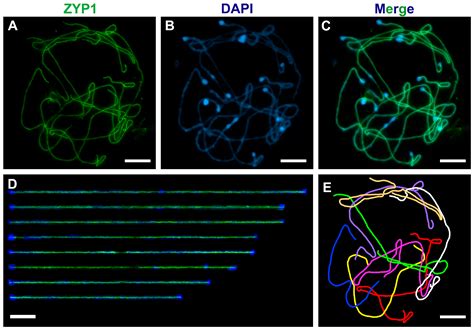 A Method of Well-Spread Pachytene Chromosome Preparations for Plant ...