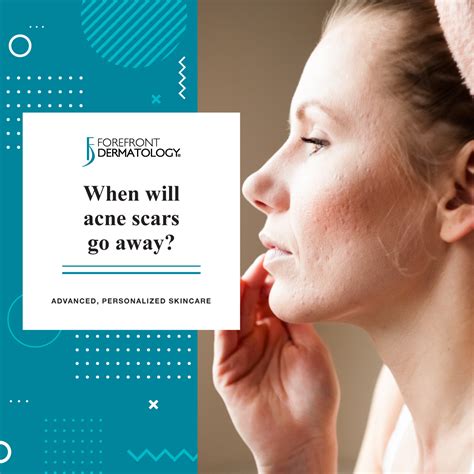 Pimple Popping Scars