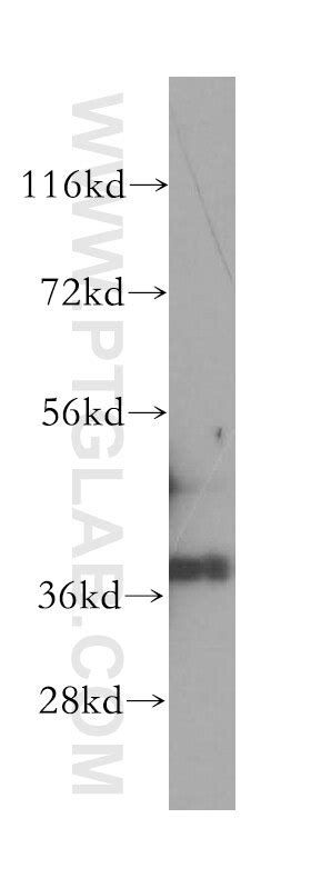 GPD1L antibody (17263-1-AP) | Proteintech
