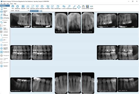 Dental Radiology Fmx