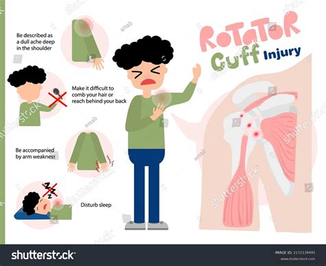 Signs Symptoms Rotator Cuff Injury Tear Stock Vector (Royalty Free) 2172139495 | Shutterstock