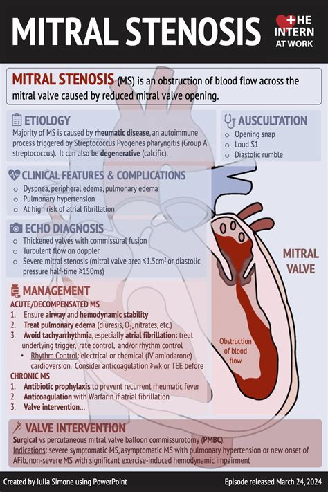 Mitral Stenosis - Medicine Pods