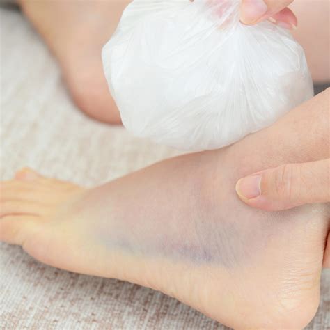 How To Help A Broken Foot - Documentride5