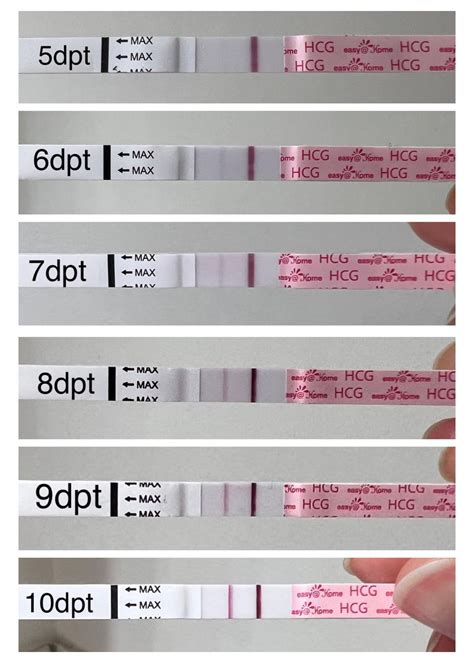 Very confused. 14 DPO. Have tested negative up until today? Extreme ...