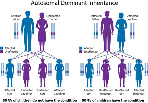 Pfeiffer syndrome causes, signs, symptoms, diagnosis & treatment
