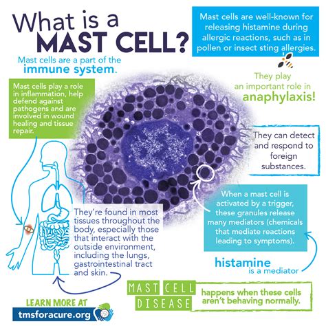 What is MCAS? - NAUGHTYLITTLEMASTCELLS