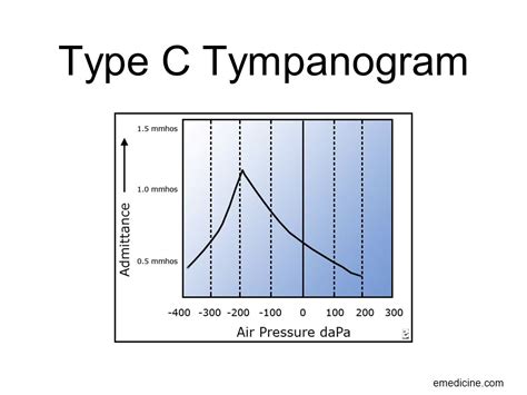 ENT Potpourri Derrick Randall & Dieter Fritz - ppt download