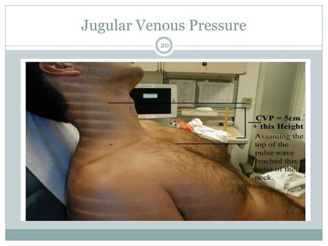 Cv physical exam - Gabriel | PPTX