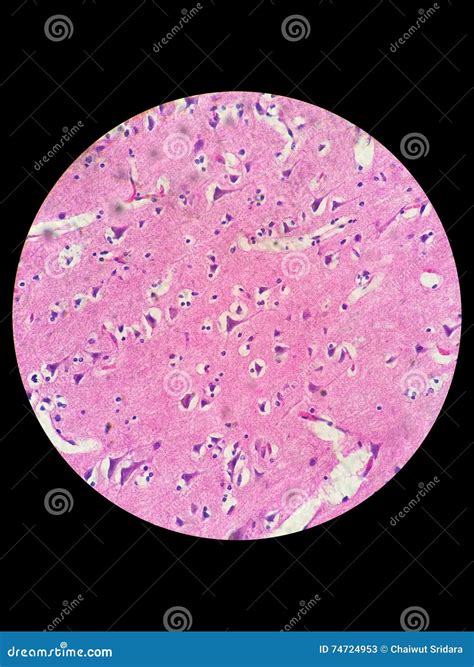 Nerve Cells Under Light Microscope Stock Image - Image of microscopic ...