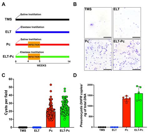Role of the Fungus Pneumocystis in IL1β Pathway Activation and Airways ...